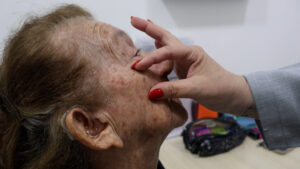 Imagem da notícia - FUnATI lança serviço de TeleDermatologia em parceria com a UFSC e amplia acesso ao diagnóstico especializado no Amazonas