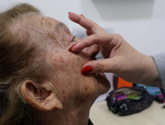 FUnATI lança serviço de TeleDermatologia em parceria com a UFSC e amplia acesso ao diagnó…